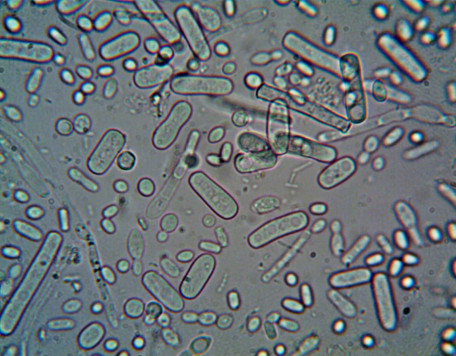 sessio bacteri min